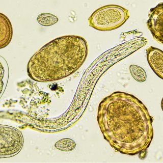 Élimine les parasites et les toxines